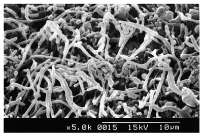 担体表面の付着微生物　電子顕微鏡写真